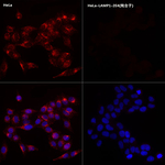 LAMP1 Recombinant Rabbit Monoclonal Antibody (1S1U5)
