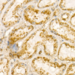 LAMP1 Antibody in Immunohistochemistry (Paraffin) (IHC (P))