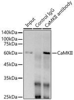 CaMKII delta Antibody in Immunoprecipitation (IP)