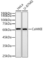 CaMKII delta Antibody in Western Blot (WB)