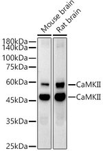 CaMKII delta Recombinant Rabbit Monoclonal Antibody (3U4X1)