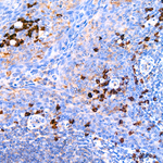 Lambda Light Chain Antibody in Immunohistochemistry (Paraffin) (IHC (P))