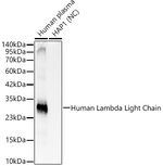 Lambda Light Chain Antibody in Western Blot (WB)