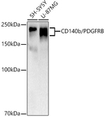 PDGFRB Recombinant Rabbit Monoclonal Antibody (4G1L4)