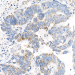 COX7A1 Antibody in Immunohistochemistry (Paraffin) (IHC (P))