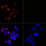 SARS-CoV-2 Nucleocapsid Recombinant Rabbit Monoclonal Antibody (6R7Q5)