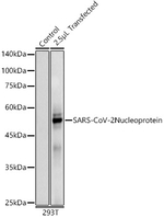 SARS-CoV-2 Nucleocapsid Antibody in Western Blot (WB)