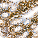 CD44 Antibody in Immunohistochemistry (Paraffin) (IHC (P))