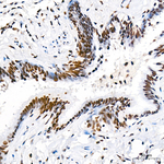 RBBP5 Antibody in Immunohistochemistry (Paraffin) (IHC (P))