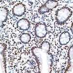 RBBP5 Recombinant Rabbit Monoclonal Antibody (7N1G3)