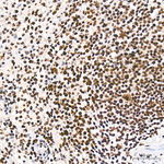 RBBP5 Antibody in Immunohistochemistry (Paraffin) (IHC (P))
