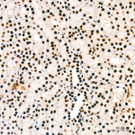 RBBP5 Antibody in Immunohistochemistry (Paraffin) (IHC (P))