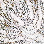 RBBP5 Antibody in Immunohistochemistry (Paraffin) (IHC (P))