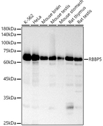 RBBP5 Antibody in Western Blot (WB)