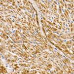 NDUFS1 Antibody in Immunohistochemistry (Paraffin) (IHC (P))