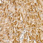 NDUFS1 Antibody in Immunohistochemistry (Paraffin) (IHC (P))