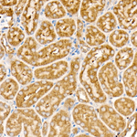 NDUFS1 Antibody in Immunohistochemistry (Paraffin) (IHC (P))