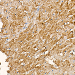 NDUFS1 Antibody in Immunohistochemistry (Paraffin) (IHC (P))