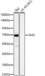 TAP2 Antibody in Western Blot (WB)