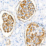 FGF1 Recombinant Rabbit Monoclonal Antibody (2S0U7)
