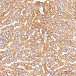 ALPK1 Recombinant Rabbit Monoclonal Antibody (5L8J4)