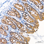 ALPK1 Antibody in Immunohistochemistry (Paraffin) (IHC (P))
