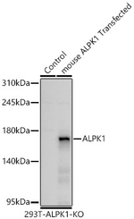 ALPK1 Antibody in Western Blot (WB)