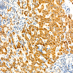 BCKDHB Antibody in Immunohistochemistry (Paraffin) (IHC (P))