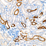 BCKDHB Antibody in Immunohistochemistry (Paraffin) (IHC (P))