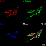 IL-18 Antibody in Immunocytochemistry (ICC/IF)