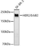 ErbB2 Recombinant Rabbit Monoclonal Antibody (8W7U2)