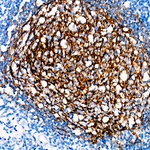 CD21 Recombinant Rabbit Monoclonal Antibody (10F9M1)