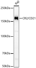 CD21 Antibody in Western Blot (WB)