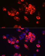 AFP Recombinant Rabbit Monoclonal Antibody (1O8I7)