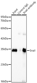 SNAIL Antibody in Immunoprecipitation (IP)