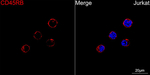 CD45RB Recombinant Rabbit Monoclonal Antibody (5S3T7)