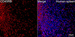 CD45RB Antibody in Immunohistochemistry (Paraffin) (IHC (P))