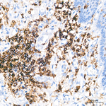 CD45RB Antibody in Immunohistochemistry (Paraffin) (IHC (P))