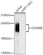 CD45RB Antibody in Western Blot (WB)