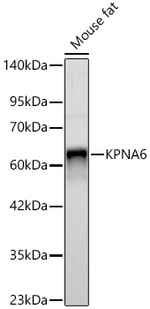 KPNA6 Antibody in Western Blot (WB)