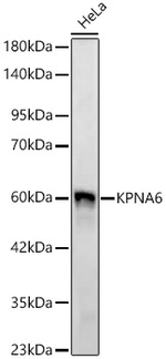 KPNA6 Antibody in Western Blot (WB)