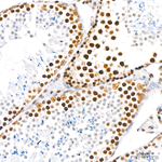 RNF2 Recombinant Rabbit Monoclonal Antibody (3N6Z9)