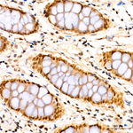 POLR2D Antibody in Immunohistochemistry (Paraffin) (IHC (P))
