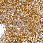 ABI3 Antibody in Immunohistochemistry (Paraffin) (IHC (P))