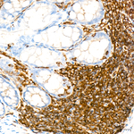 ABI3 Antibody in Immunohistochemistry (Paraffin) (IHC (P))