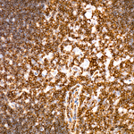 ABI3 Antibody in Immunohistochemistry (Paraffin) (IHC (P))