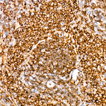 ABI3 Antibody in Immunohistochemistry (Paraffin) (IHC (P))