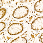 H3K36me1 Recombinant Rabbit Monoclonal Antibody (3B0Q10)
