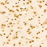 H3K36me1 Antibody in Immunohistochemistry (Paraffin) (IHC (P))