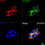ENO3 Recombinant Rabbit Monoclonal Antibody (6N4Y5)